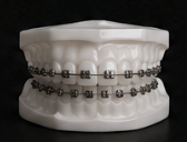 Ortodoncia / Brackets