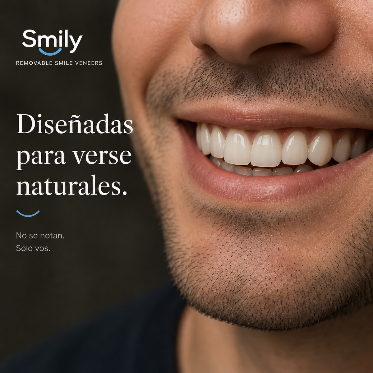 Carillas Dentales