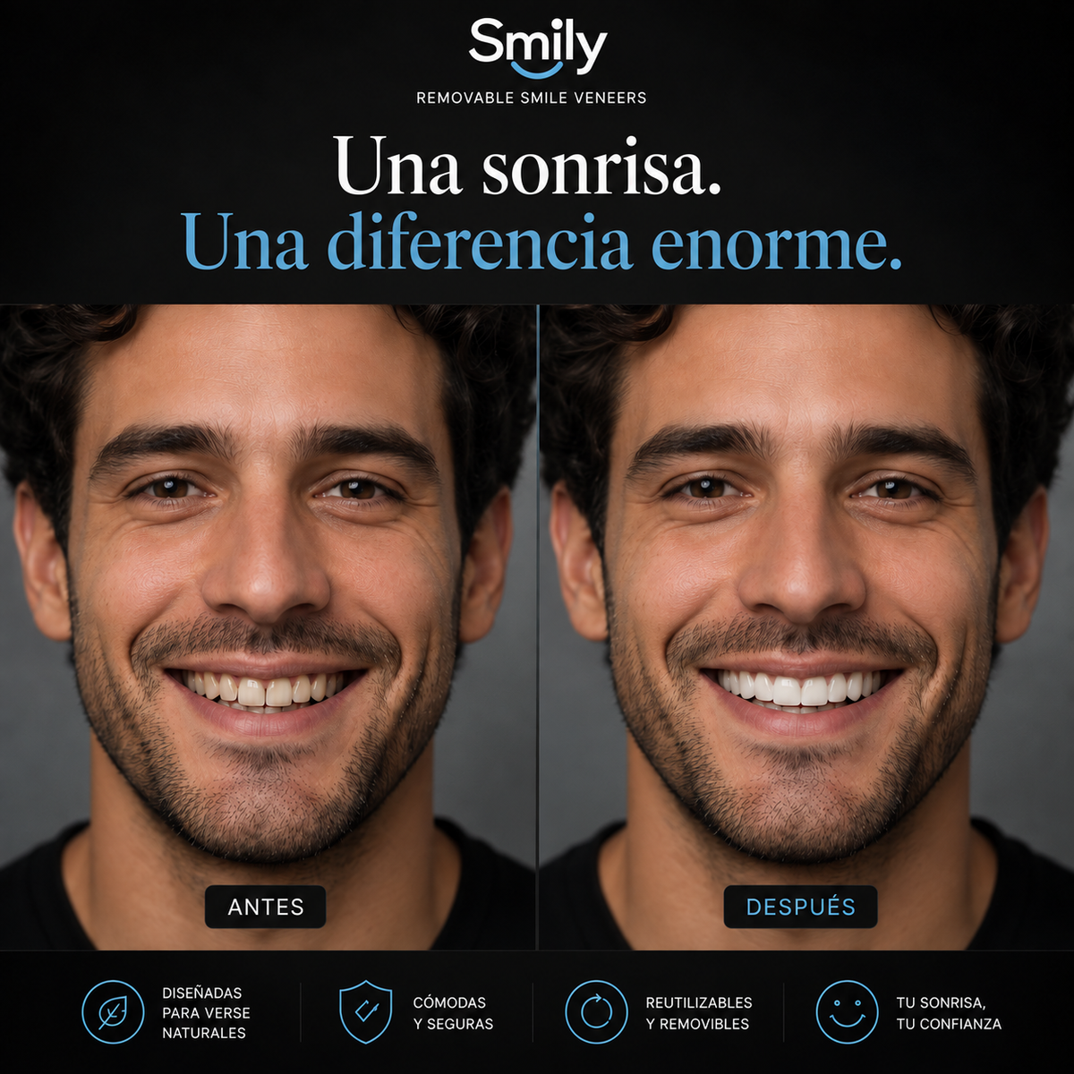Carillas Dentales