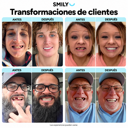 Carillas Dentales