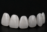 Carillas de porcelana